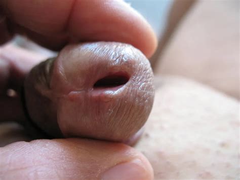 Open Peehole 37 Nude Pics XHamster