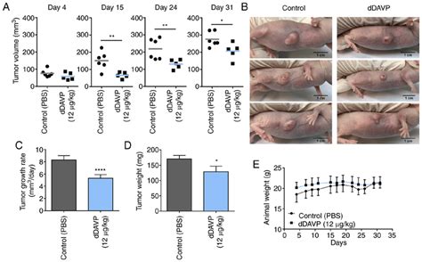 Sustained Administration Of DDAVP Slows Human Osteosarcoma Xenograft