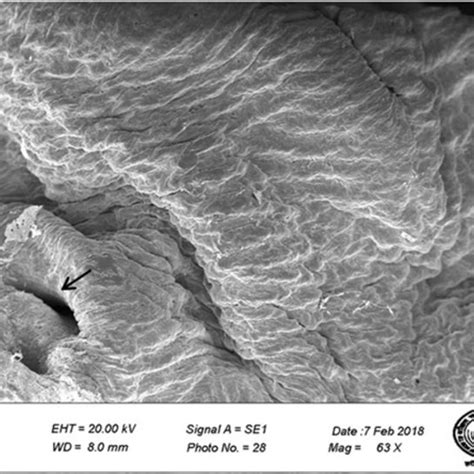 Scanning Electron Micrograph At Higher Magnification Showing