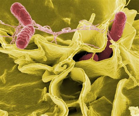 La Lista De 12 Superbacterias De La Oms No Es Más Que El Principio El