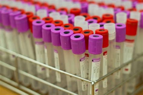 Бесплатные анализы по ОМС: что делать, если за них приходится платить ...