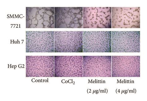 Effect Of Melittin On Hypoxia Induced VM Formation Of Hepatoma Cells