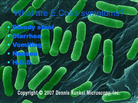 PPT - All About Escherichia Coli! PowerPoint Presentation, free ...