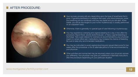 Hysteroscopy Procedures Risks And Consult With Physician Ppt