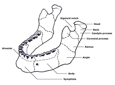 Fracture Fridays Mandible Fractures Pem Blog