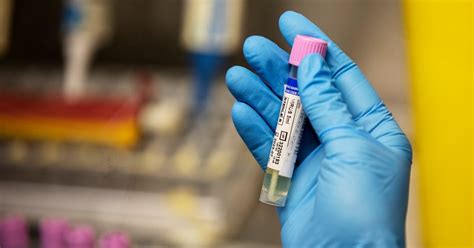 Monkeypox Vaccines Offered To Gay And Bisexual Men In New York Canada And U K