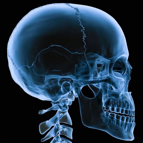 Снимок головы ребенка у невролога - фото презентация