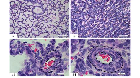 Masson S Trichrome Staining Of Lungs A The Normal Lung Parenchyma From Download Scientific