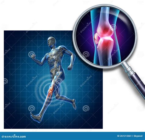 Lesión De Rodilla De Los Deportes Stock de ilustración - Ilustración de