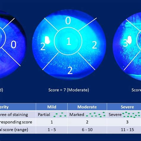 Different Patterns Of Tfbut At Different Time Elapsed After Blinking In Download Scientific