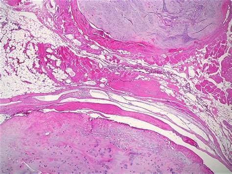 Pathology Outlines - Case of the Week #66