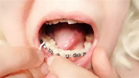 Latex MILF liebt es dehnt und in muschi gefistet zu werden heißes glänzendes kurviges