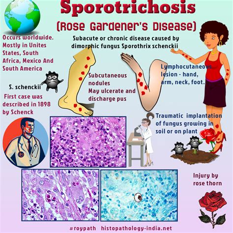 Common Diseases Caused by Fungi - Gordon MacLeod