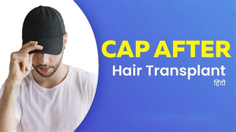 क्या आप Hair Transplant के बाद Cap पहन सकते हैं Youtube