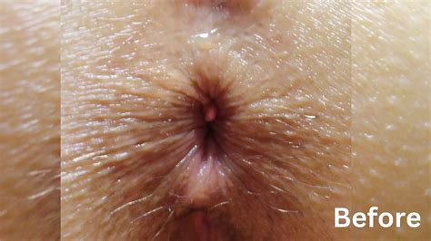 Lala Licious Anal Play And Stretching Anal Beads Porn By FapHouse XHamster