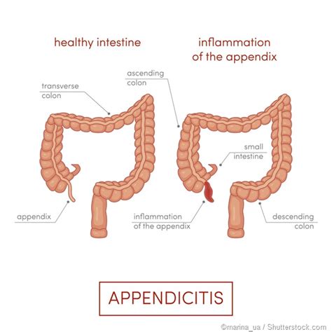 appendix