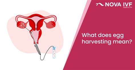 egg harvesting process explained   expect nova ivf