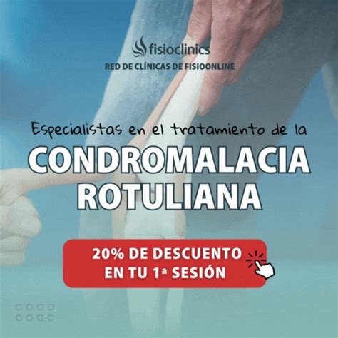 Tratamiento De La Condromalacia Rotuliana Izquierda FisioOnline