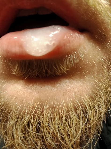 Cum On Mounth Nude Pics XHamster