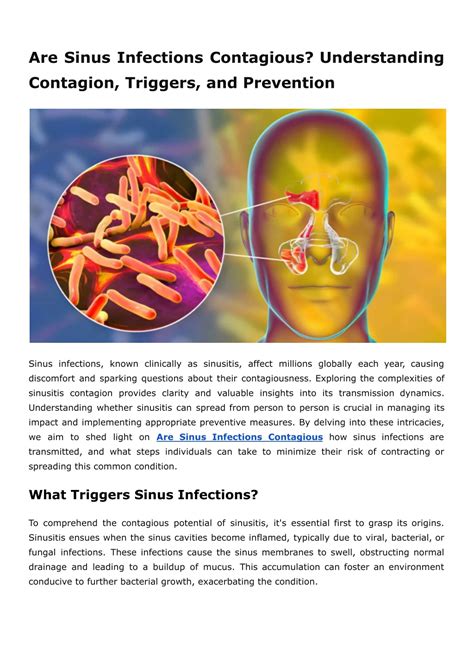 Ppt Are Sinus Infections Contagious Understanding Contagion