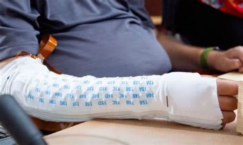 brain computer interface restores mans sense  touch