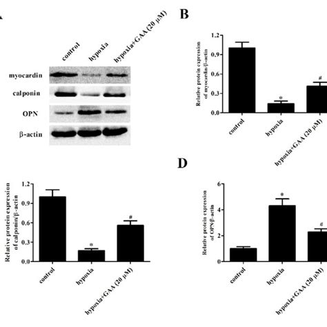 Gaa Regulates Hypoxia Induced Dedifferentiation Of Pasmcs Pasmcs Were