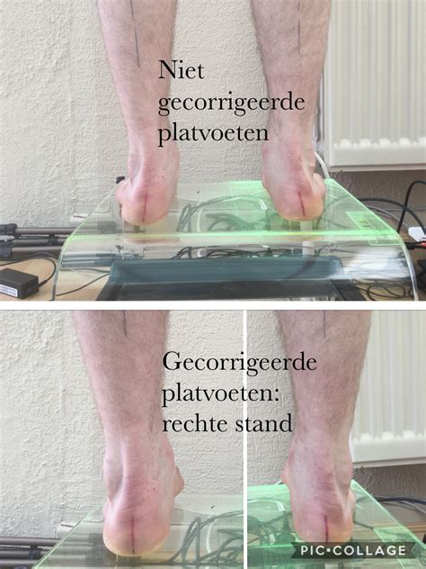 Correctie Zolen Steunzolen Sportcorrectie Zolen Podoloog Anke Tonniau