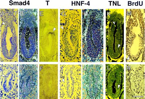 The Tumor Suppressor Gene Smad Dpc Is Required For Gastrulation And