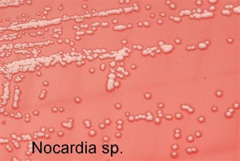 What Is The Difference Between Nocardia And Actinomyces Pediaacom