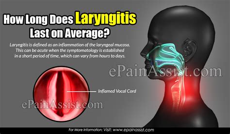 How Long Does Laryngitis Last