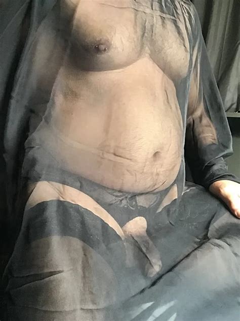 Fat Willi Nude Pics XHamster