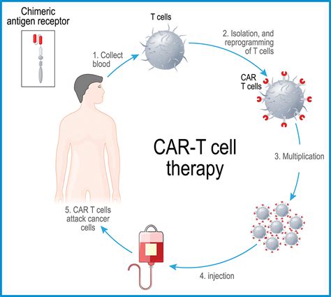 The Latest In Car T Cell Therapy For Pediatric Cancer