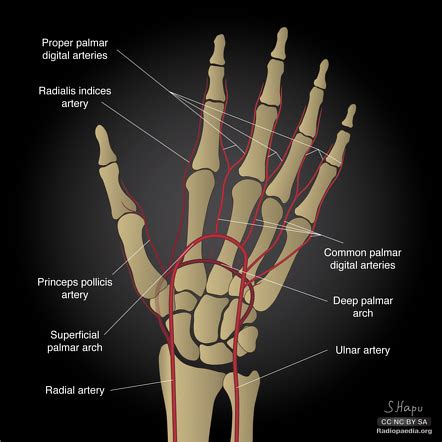 Proper dorsal digital arteries | Radiology Reference Article ...