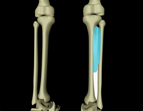 Tibialis posterior – Myoreflex
