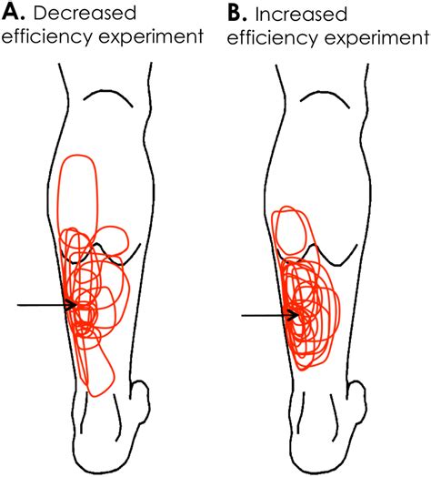 Area of perceived pain for each experiment. The injection site (arrow)... | Download Scientific ...