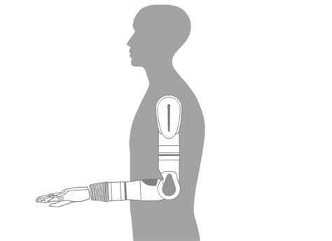 Luke Arm Detail Page Mobius Bionics