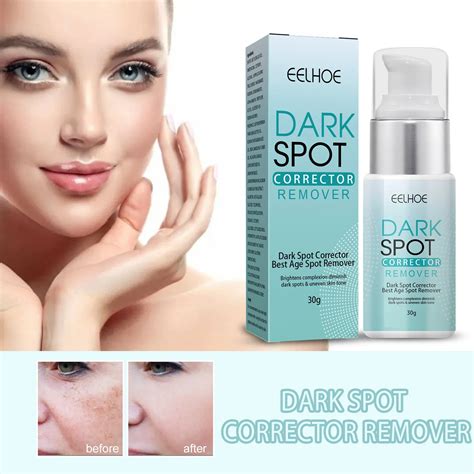 Nicotinamide Whitening Freckle Cream Dark Spot Remover Skin Care