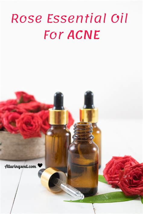 15 Best Essential Oils For Acne And Recipes