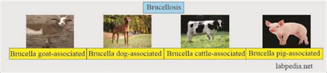 Brucellosis Diagnosis Of Brucella Infection