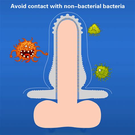 Unique Penis Sleeve For Safe Anal Sex UDATZ