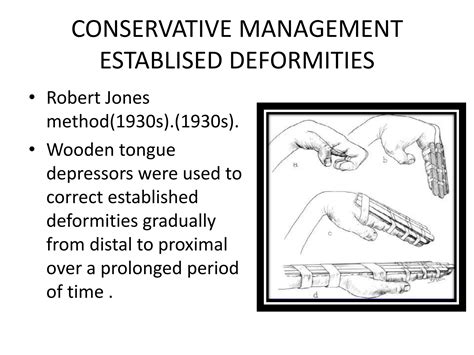 Volkmann¶s Ischemic Contracture Ppt