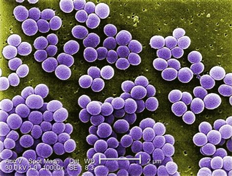 Mengenal Staphylococcus Aureus Bakteri Keracunan Makanan