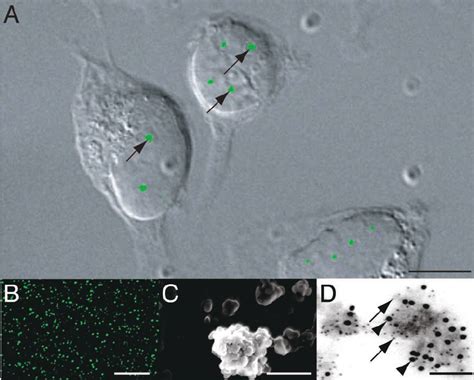 cajal bodies  hela cells expressing  fpcoilin fusion protein