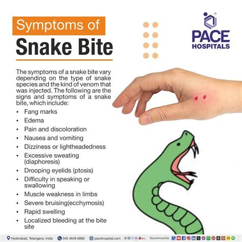 Snake Bite: Types, Symptoms, Causes, Diagnosis & Treatment