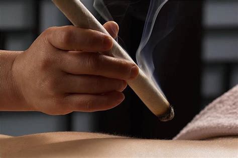 Moxibustion Treatment Singapore Sin Kang Tcm