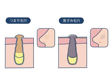 bihadadotokyo