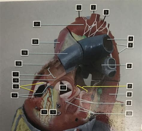 Lab Practical Heart Diagram Quizlet