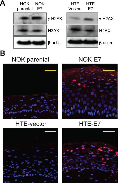 Figure 1 From Human Papillomavirus Type 16 E7 Oncoprotein Causes A