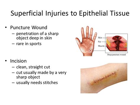 Epithelial Tissue Wound