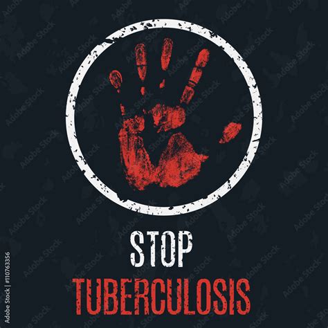 Stop Tuberculosis
